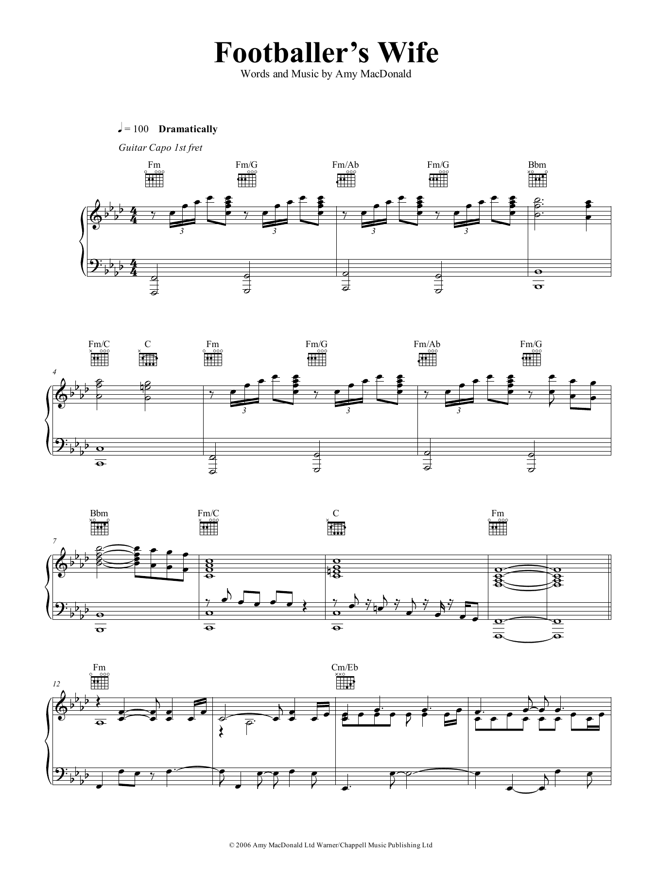 Amy MacDonald The Footballer's Wife Sheet Music Notes & Chords for Piano, Vocal & Guitar (Right-Hand Melody) - Download or Print PDF