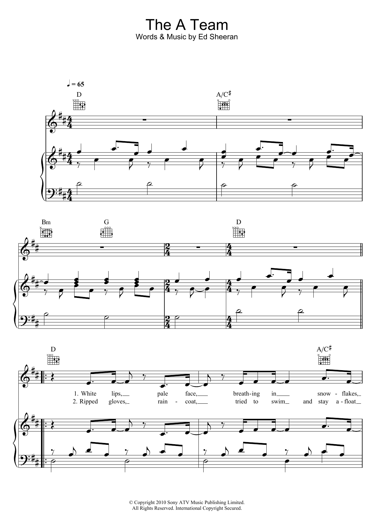 Birdy The A Team Sheet Music Notes & Chords for Piano, Vocal & Guitar (Right-Hand Melody) - Download or Print PDF