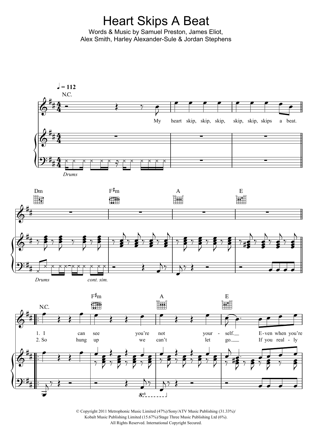 Olly Murs Heart Skips A Beat Sheet Music Notes & Chords for Piano, Vocal & Guitar (Right-Hand Melody) - Download or Print PDF
